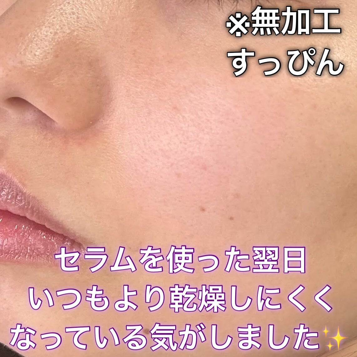 SOOTHING REPAIR TONING SERUM R4/ダーマファーム/美容液を使ったクチコミ(6枚目)