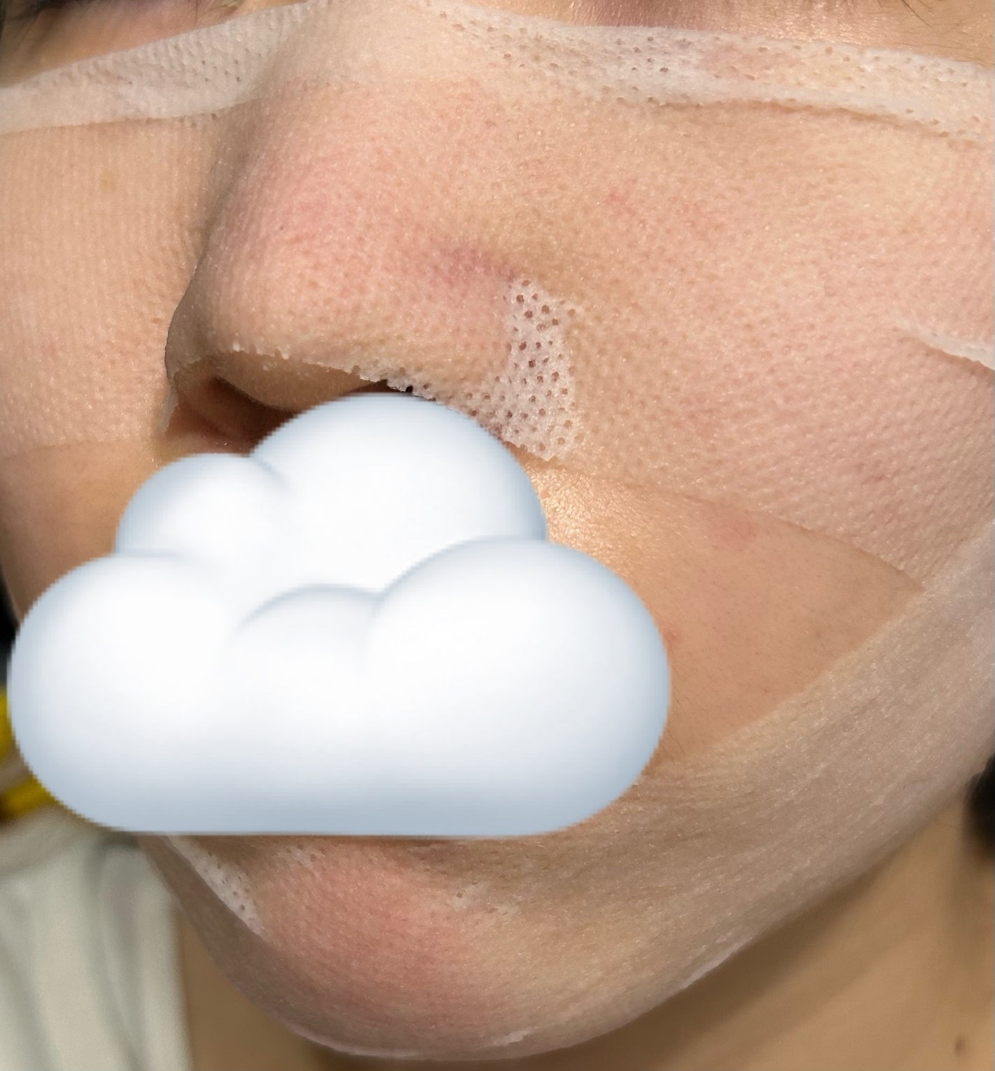 イージーチョップバンドマスク ユースシェーパー/lalachuu/シートマスク・パックを使ったクチコミ(4枚目)