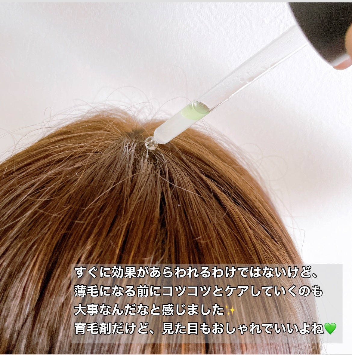 薬用 メディカル アンチヘアロスセラム/L'OCCITANE/頭皮ローションを使ったクチコミ(4枚目)