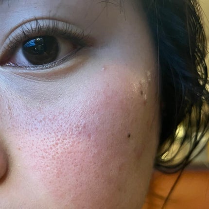 ティーツリーケア ソリューション エッセンシャルマスクEX/MEDIHEAL/シートマスク・パックを使ったクチコミ(2枚目)