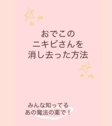 こんにちは！
チベットスナギツネです🦊

今回は今まで前髪で隠してたおでこの大量の"ニキビさん"を消し去った方法を伝えたいと思います！



私は前髪あげるのが似合わなくて(ﾉД`)ずーーーーっと眉下の