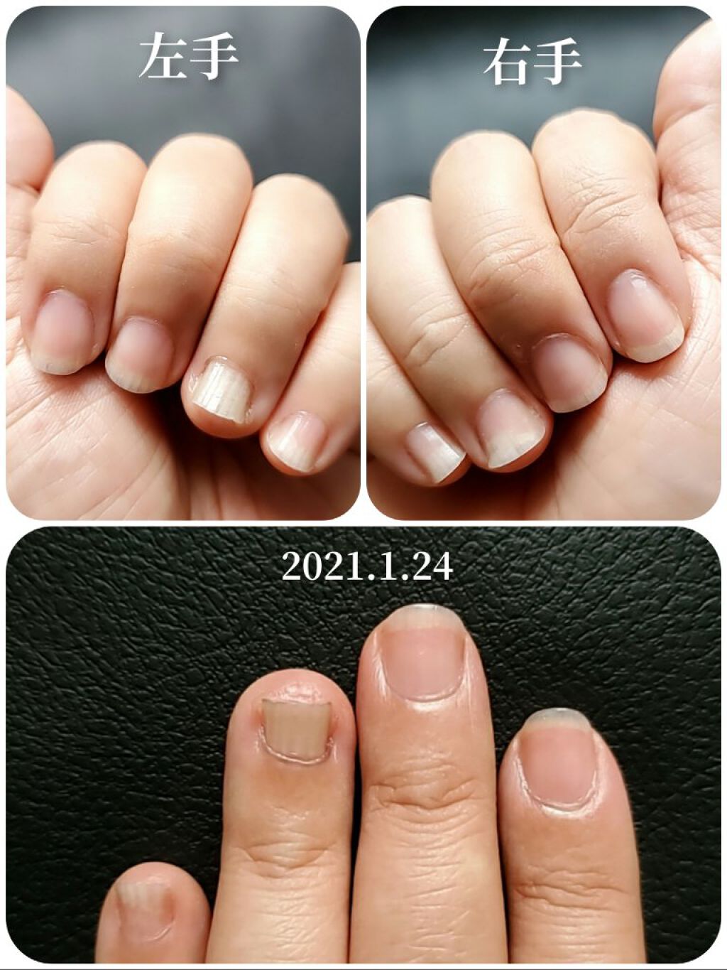 エテュセ クイックケアコート/ettusais/ネイルオイル・トリートメントを使ったクチコミ(3枚目)