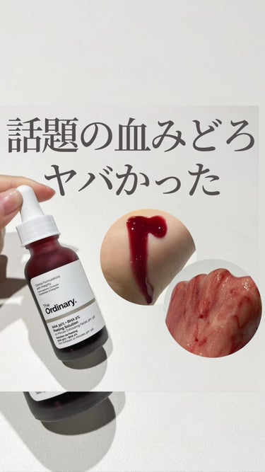 AHA 30% + BHA 2% Peeling Solution/The Ordinary/ピーリングの動画クチコミ1つ目