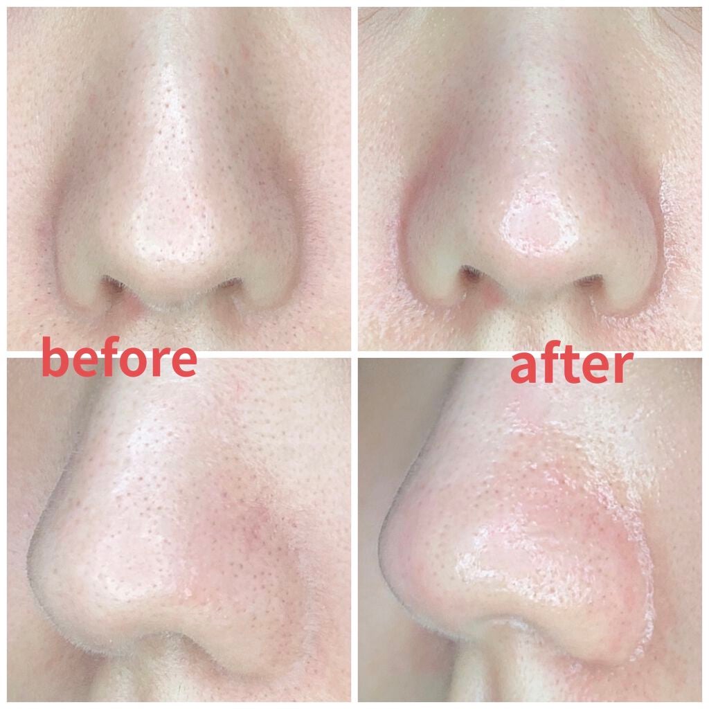 ポアヌーク ザ・ポアクリアスティック/STYLE+NOBLE/その他スキンケアグッズを使ったクチコミ(2枚目)