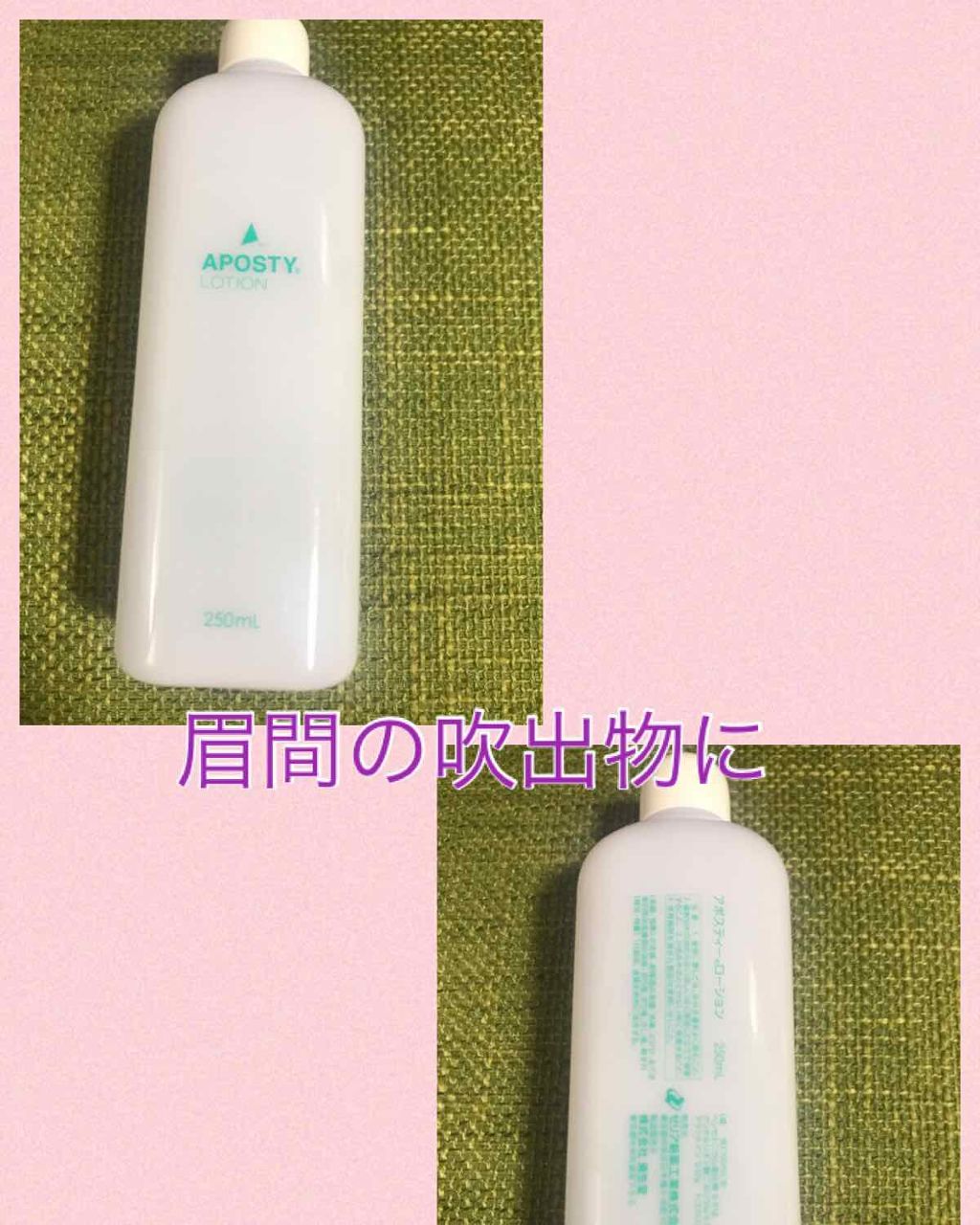 アポスティーローション(医薬品)/アポスティー/その他を使ったクチコミ(1枚目)