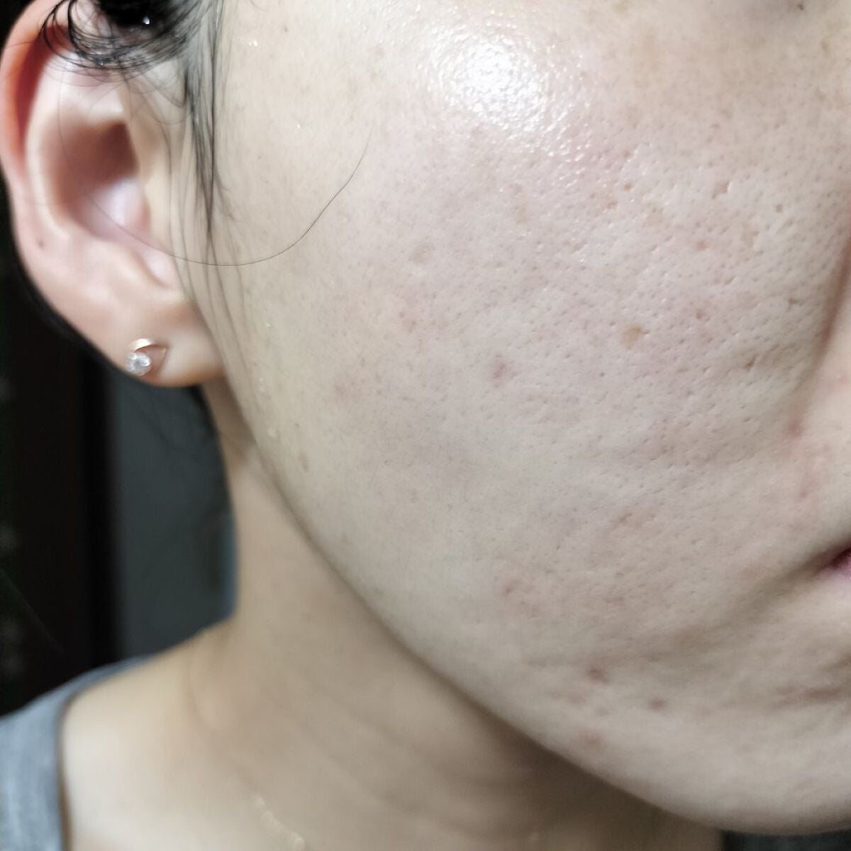 レチノールA 1% アドバンスドリバイタリゼーションクリーム/Life-flo/フェイスクリームを使ったクチコミ(1枚目)