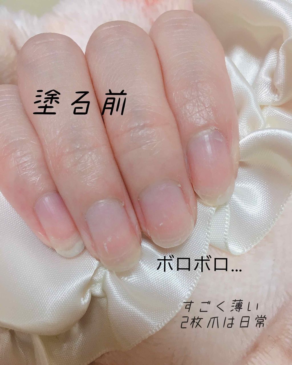 葵 On Lips 肌と同じくらい悩みが多い私の爪薄い 弱い 割れる めくれる と Lips