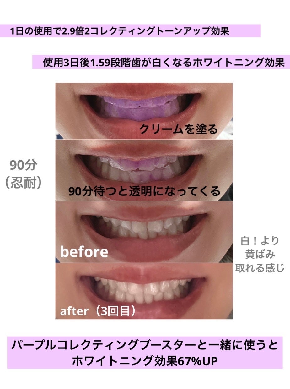 ã¡ãð on LIPS ãEUTHYMOLïŒãŠãŒã·ã¢ãŒã«ïŒãã¯ã€ããã³ã°ããŒãã«ã³ã¬ã¯ã¿..ãïŒ4æç®ïŒ