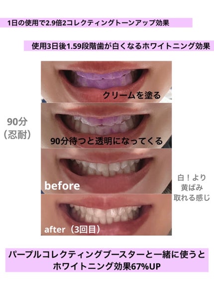 ã¡ãð on LIPS ãEUTHYMOLïŒãŠãŒã·ã¢ãŒã«ïŒãã¯ã€ããã³ã°ããŒãã«ã³ã¬ã¯ã¿..ãïŒ4æç®ïŒ