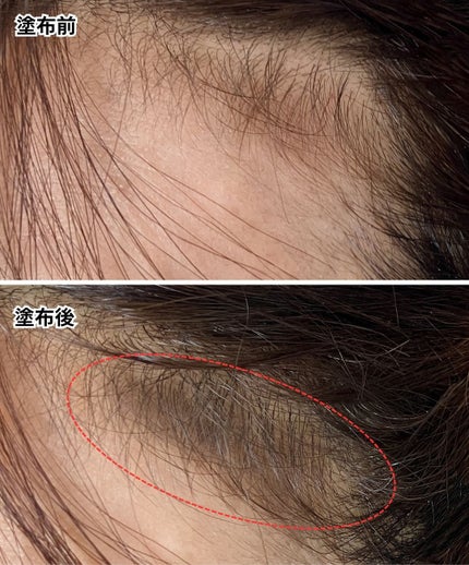 ヘアマスカラ/ビゲン/ヘアカラーを使ったクチコミ(7枚目)