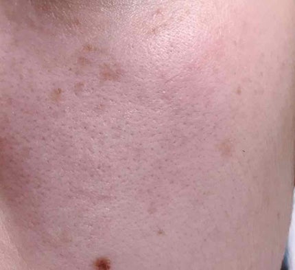 パーフェクトUVリキッドファンデーション/オルビス/リキッドファンデーションを使ったクチコミ(2枚目)