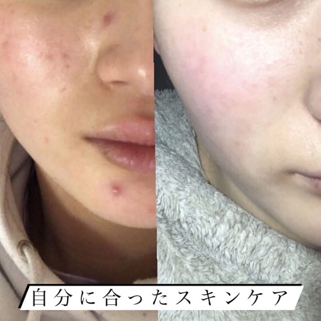 セラミエイド 薬用スキンクリーム/セラミエイド/フェイスクリームを使ったクチコミ（1枚目）