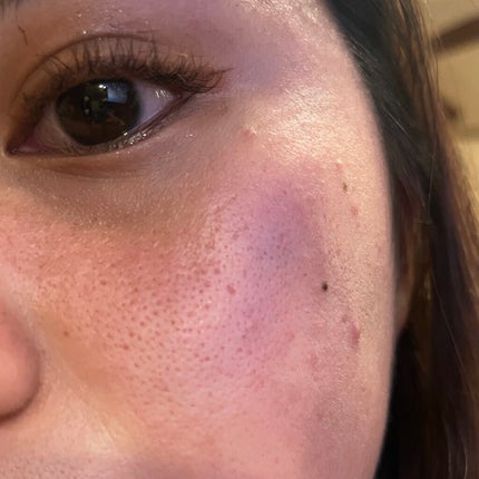 ティーツリーケア ソリューション エッセンシャルマスクEX/MEDIHEAL/シートマスク・パックを使ったクチコミ(1枚目)