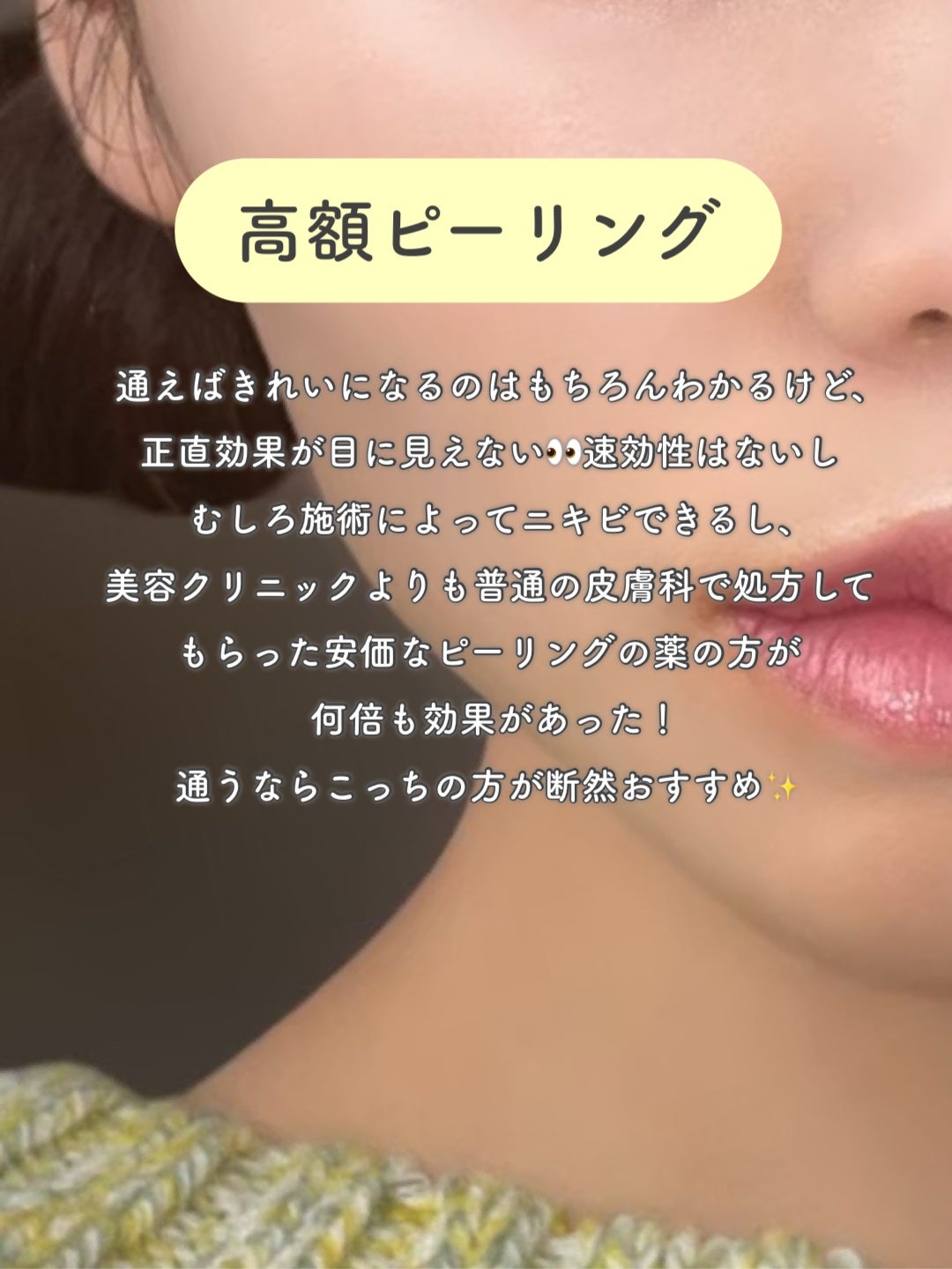 サファイアIPL脱毛器 /yete/家庭用脱毛器を使ったクチコミ(2枚目)