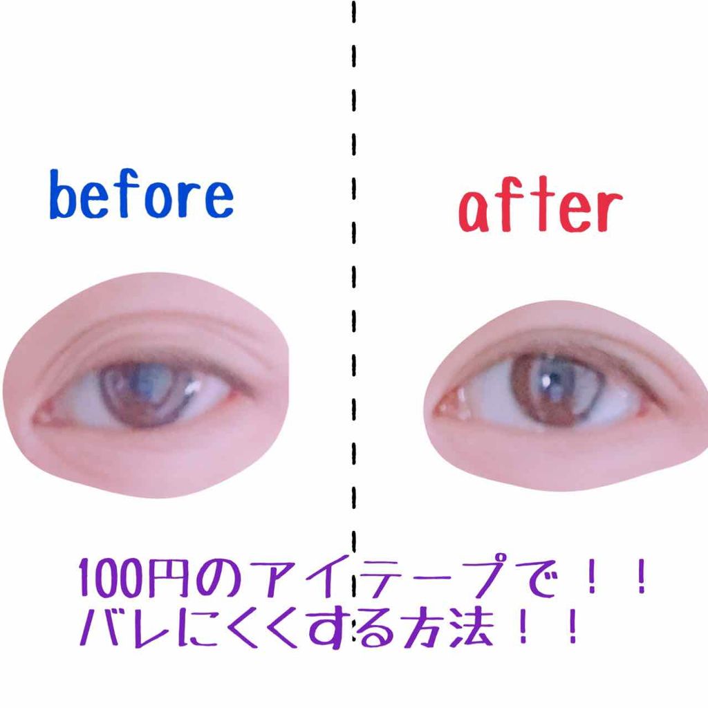 のび〜る アイテープ 両面テープタイプ/DAISO/二重まぶた用アイテムを使ったクチコミ（1枚目）