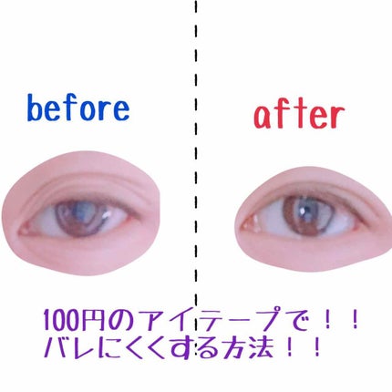 のび〜る アイテープ 両面テープタイプ/DAISO/二重まぶた用アイテムを使ったクチコミ(1枚目)