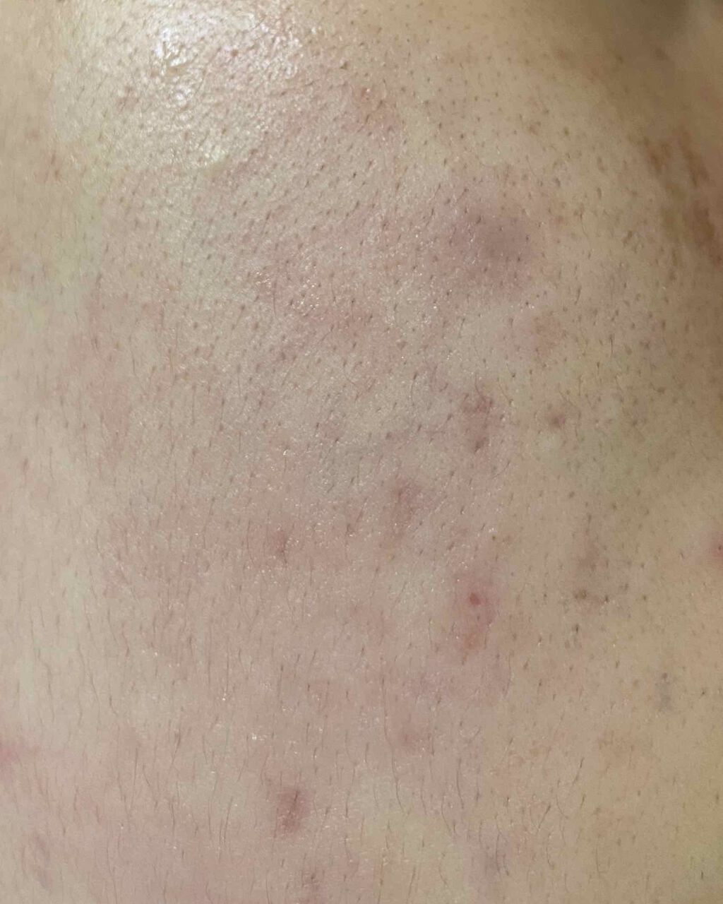 潤い化粧水/ももぷり/化粧水を使ったクチコミ(2枚目)