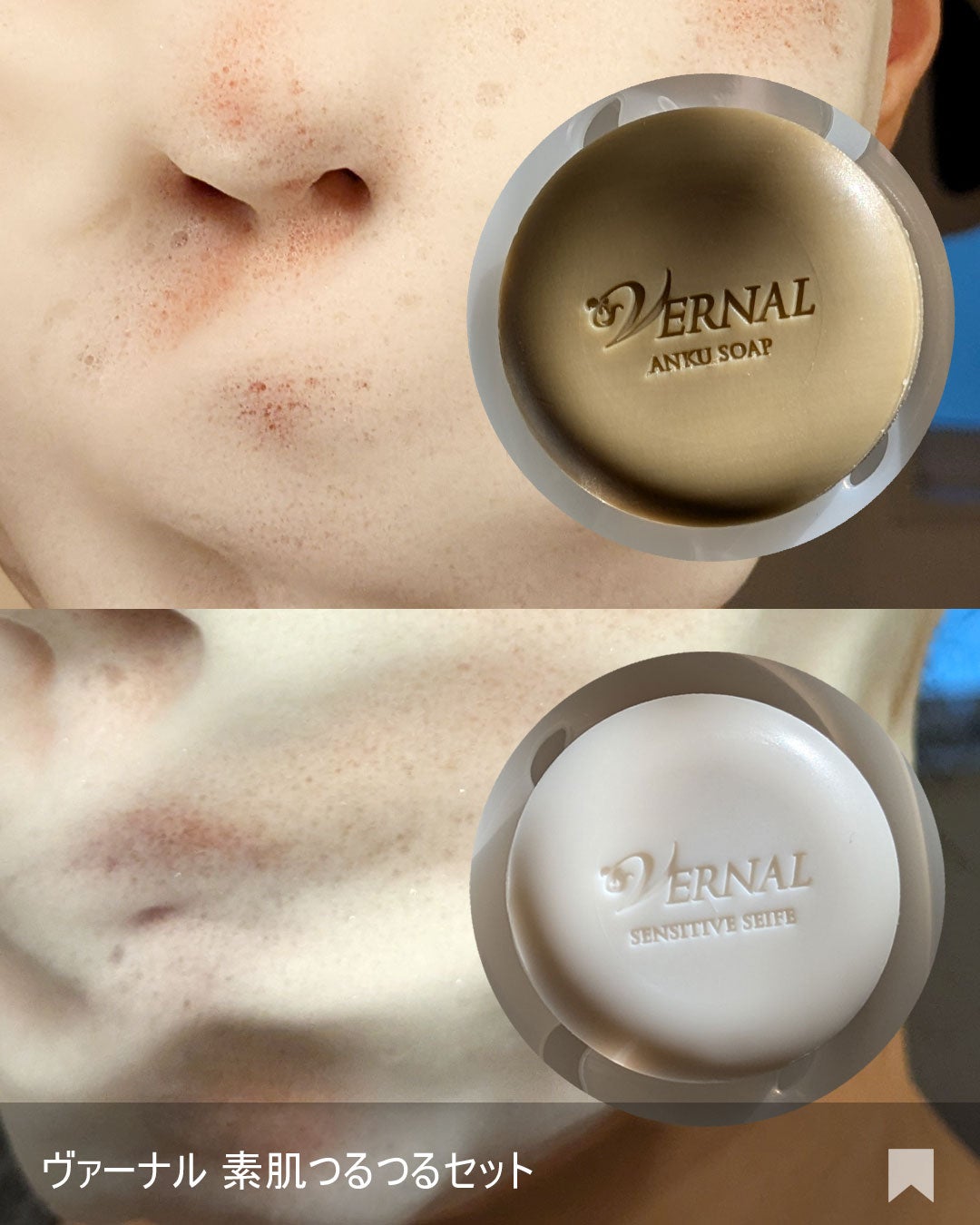 素肌つるつるセット/ヴァーナル/スキンケアキットを使ったクチコミ(5枚目)