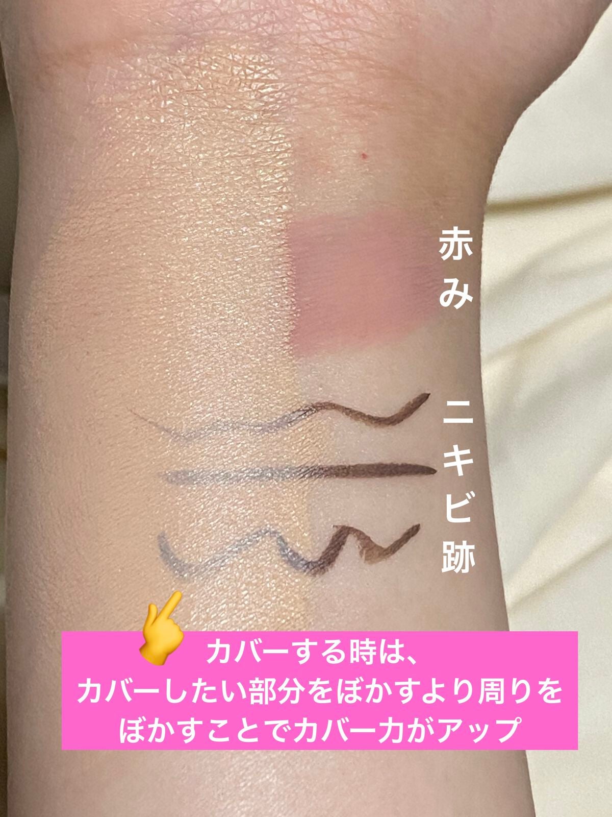 ダーマシンコンシーラー/23years old/リキッドコンシーラーを使ったクチコミ(3枚目)