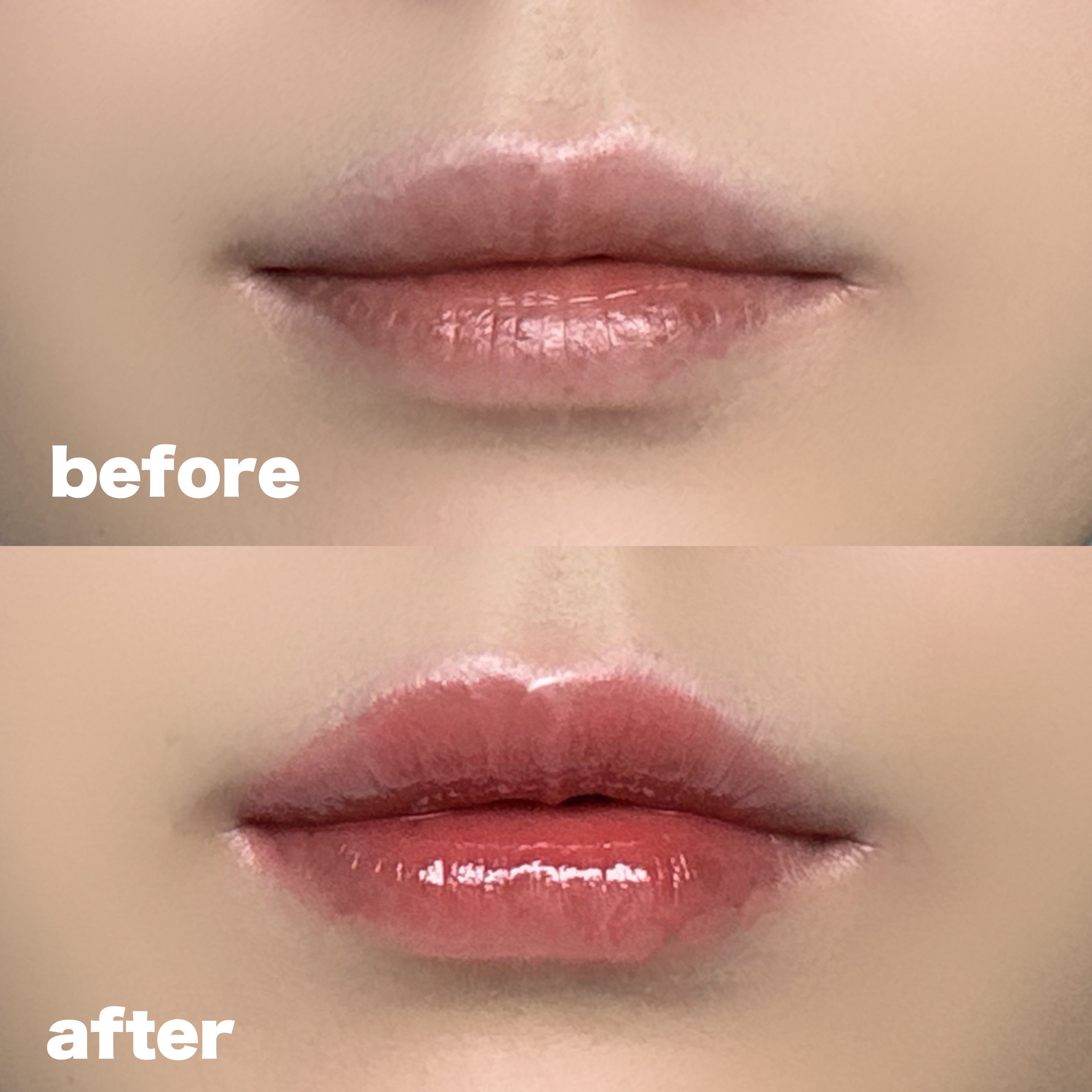 ドトムリッププラスプランパー 03 スプリングダーリン(SPRING DARLING)/keybo/リッププランパーを使ったクチコミ（2枚目）