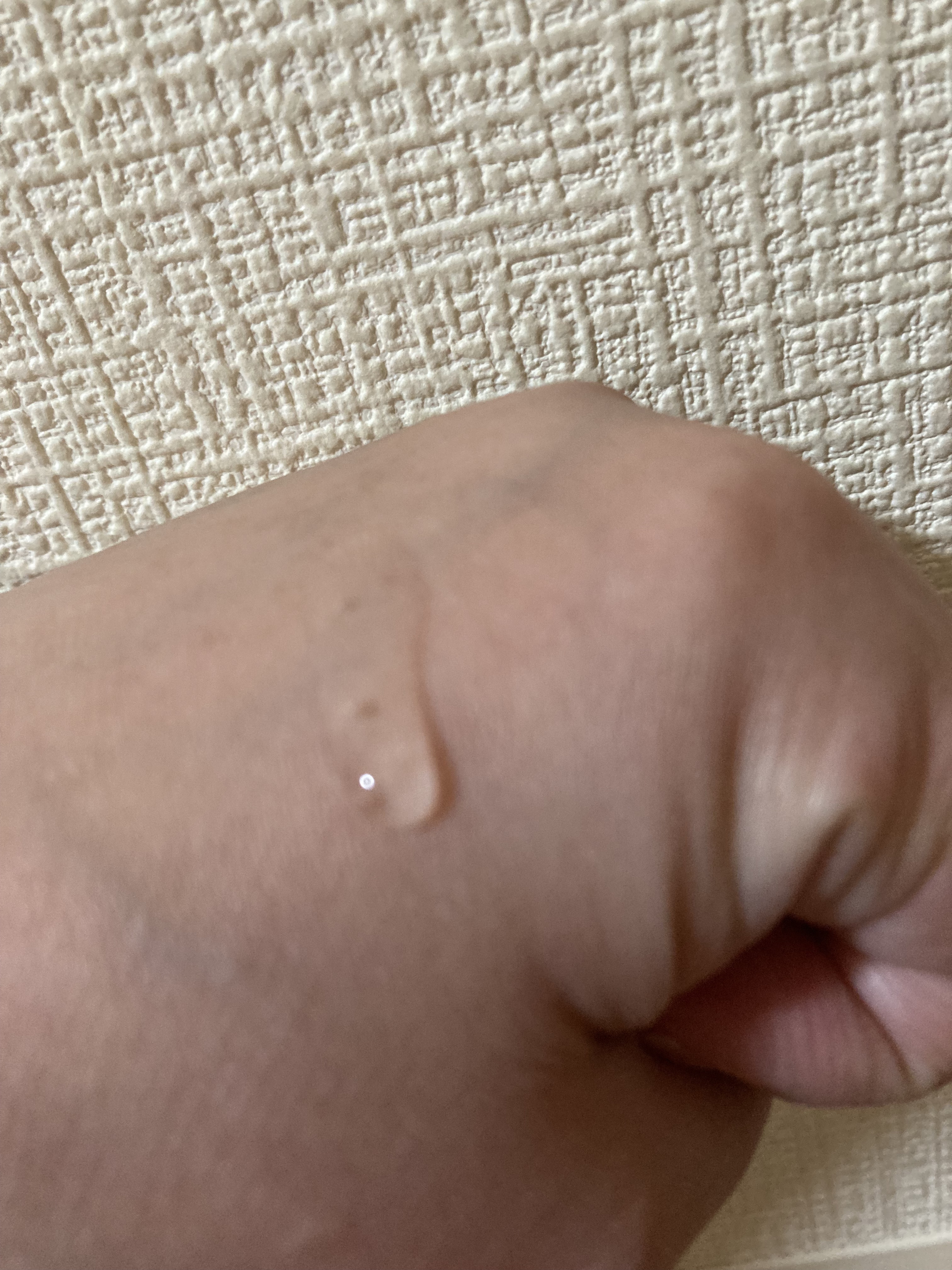 カンダンバリア エッセンス/d プログラム/美容液を使ったクチコミ（2枚目）