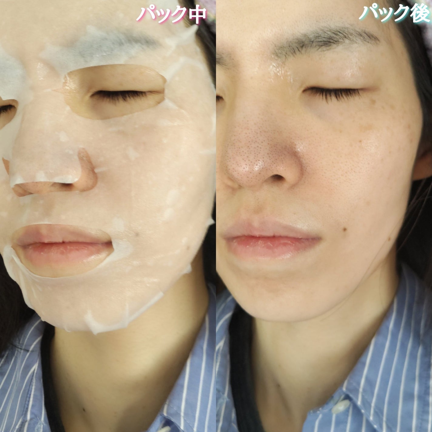 ビタ ジェニックゼリーマスク/BANOBAGI/シートマスク・パックを使ったクチコミ(8枚目)