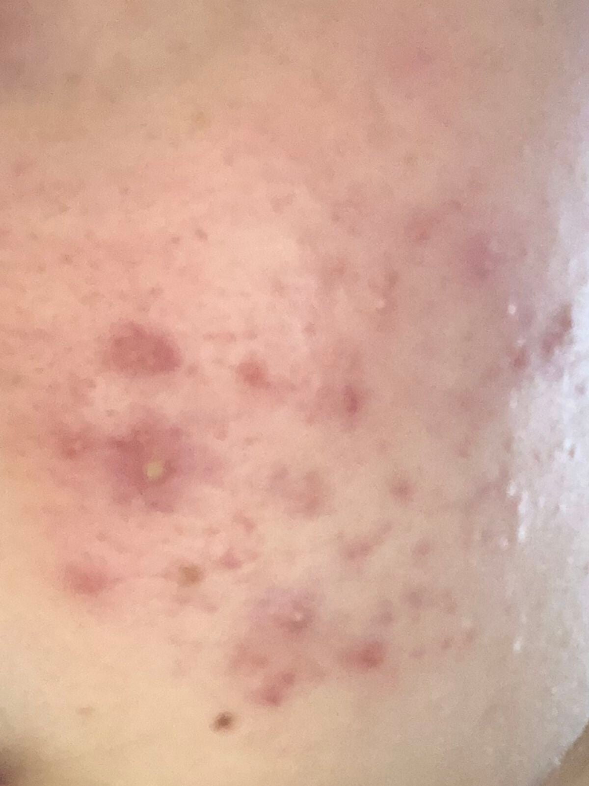 ハトムギ化粧水(ナチュリエ スキンコンディショナー R )/ナチュリエ/化粧水を使ったクチコミ(2枚目)