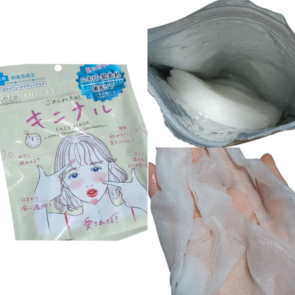 ごめんね素肌 キニナルマスク/クリアターン/シートマスク・パックを使ったクチコミ（3枚目）