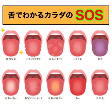 ミリミリ|美容アカウント on LIPS 「『舌でわかるカラダの状態』それSOSサインかも！？◯ふちがボコ..」（1枚目）