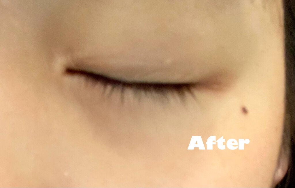 アイラッシュセラム/THE STEM CELL/まつげ美容液を使ったクチコミ(3枚目)