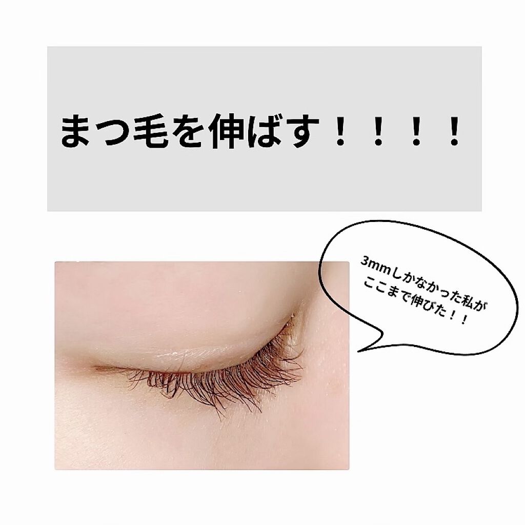 アデノバイタル アイラッシュセラム/資生堂プロフェッショナル/まつげ美容液を使ったクチコミ（1枚目）