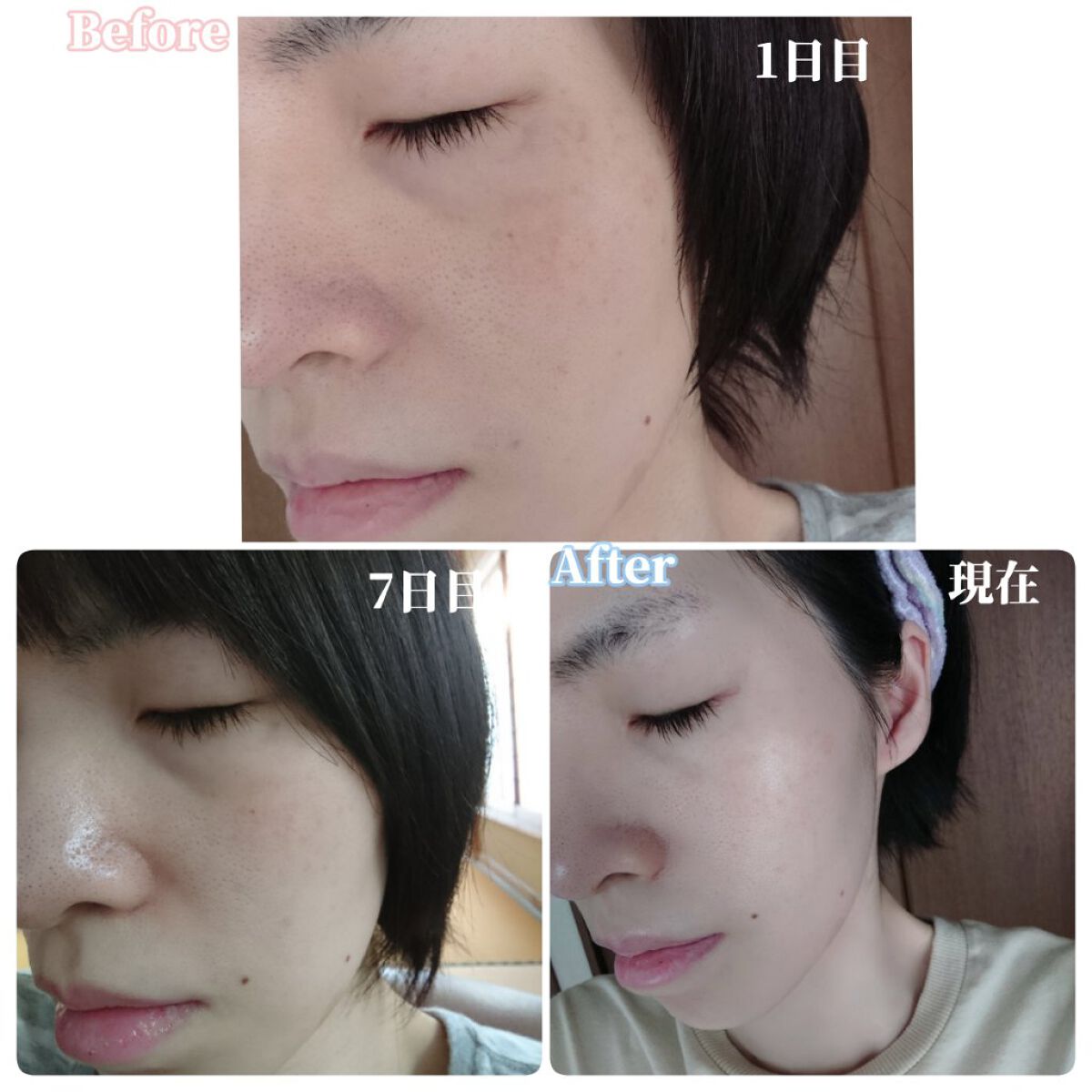 ðð®ðððð¢â¡ on LIPS ãããã«ã¡ã¯ïŒèæ©ã¿ã®æ ¹æ¬ã解決ããææèããã®ãŽã£ãŒã¬ã³ãã¥ãŒ..ãïŒ8æç®ïŒ