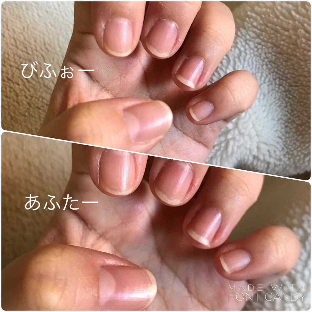 561円 アウトレット アンドネイル キューティクルリムーブペン 1 8ml