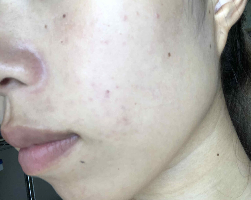 クリアトライアルセット M（しっとりタイプ）/オルビス/トライアルキットを使ったクチコミ（3枚目）