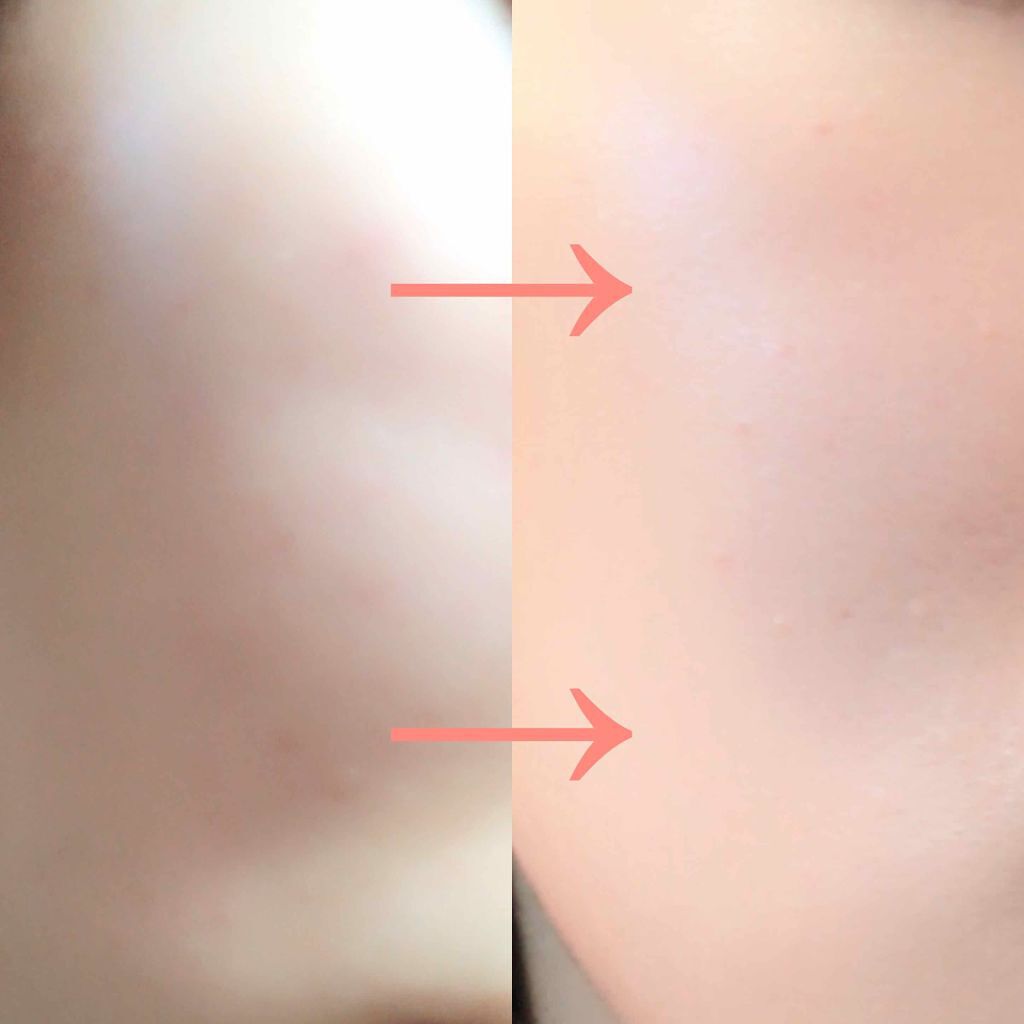 ニベアクリーム/ニベア/ボディクリームを使ったクチコミ(2枚目)