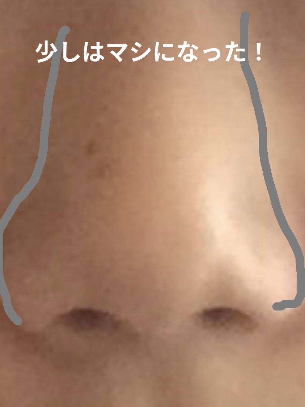 お鼻リフォーマー ハナハナ/グッズマン/その他を使ったクチコミ（2枚目）