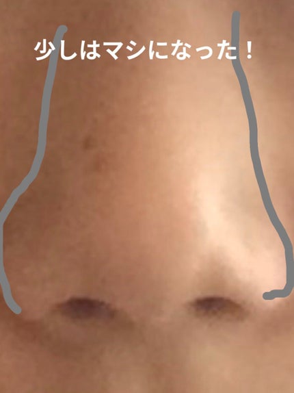お鼻リフォーマー ハナハナ/グッズマン/その他を使ったクチコミ(2枚目)