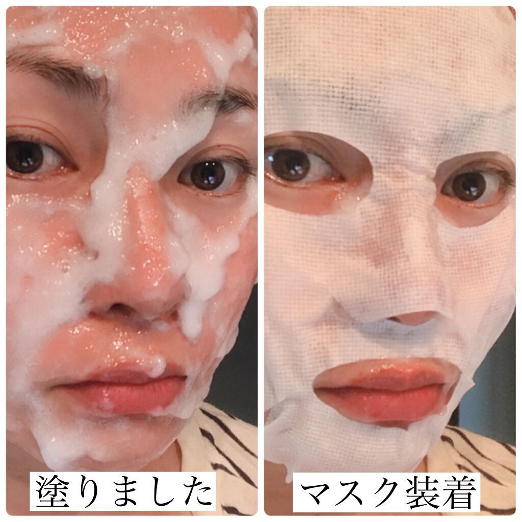 スパークリングパック/Urar /シートマスク・パックを使ったクチコミ(7枚目)