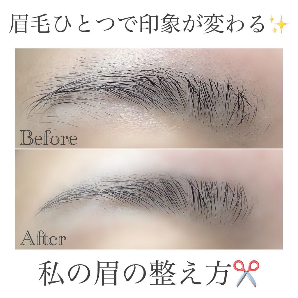 プレミア敏感肌用 Lディスポ/シック/シェーバーを使ったクチコミ(1枚目)