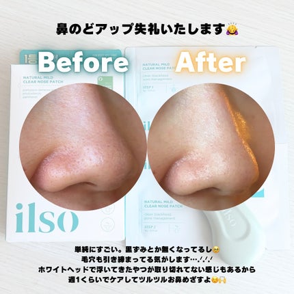 ナチュラルマイルドクリアノーズパック/ilso/シートマスク・パックを使ったクチコミ(4枚目)
