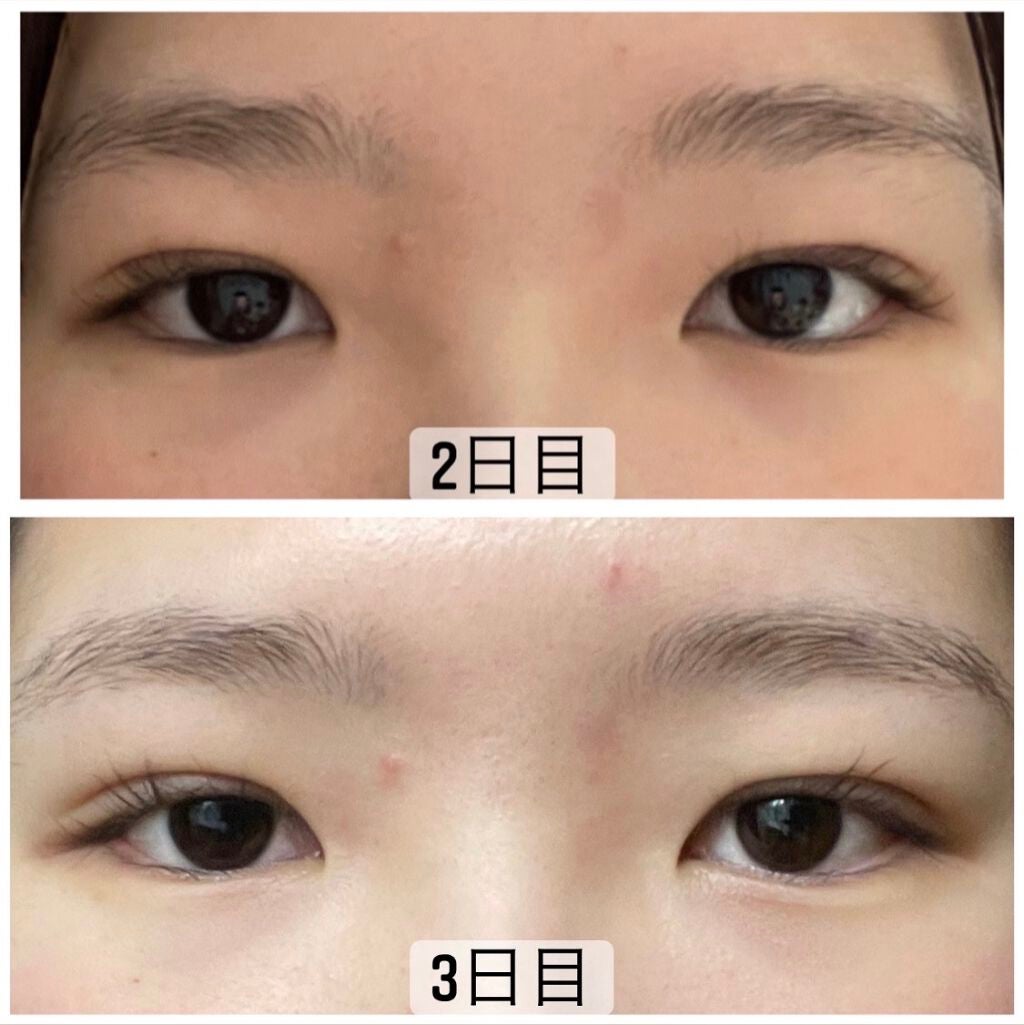 しろもち on LIPS 「3日目!!ほとんど何も変わらない。ここからは少しずつしか変わら..」(1枚目)