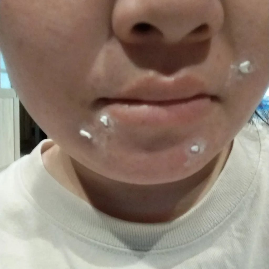 薬用ニキビケア スポッツクリーム/アクネスラボ/フェイスクリームを使ったクチコミ（3枚目）