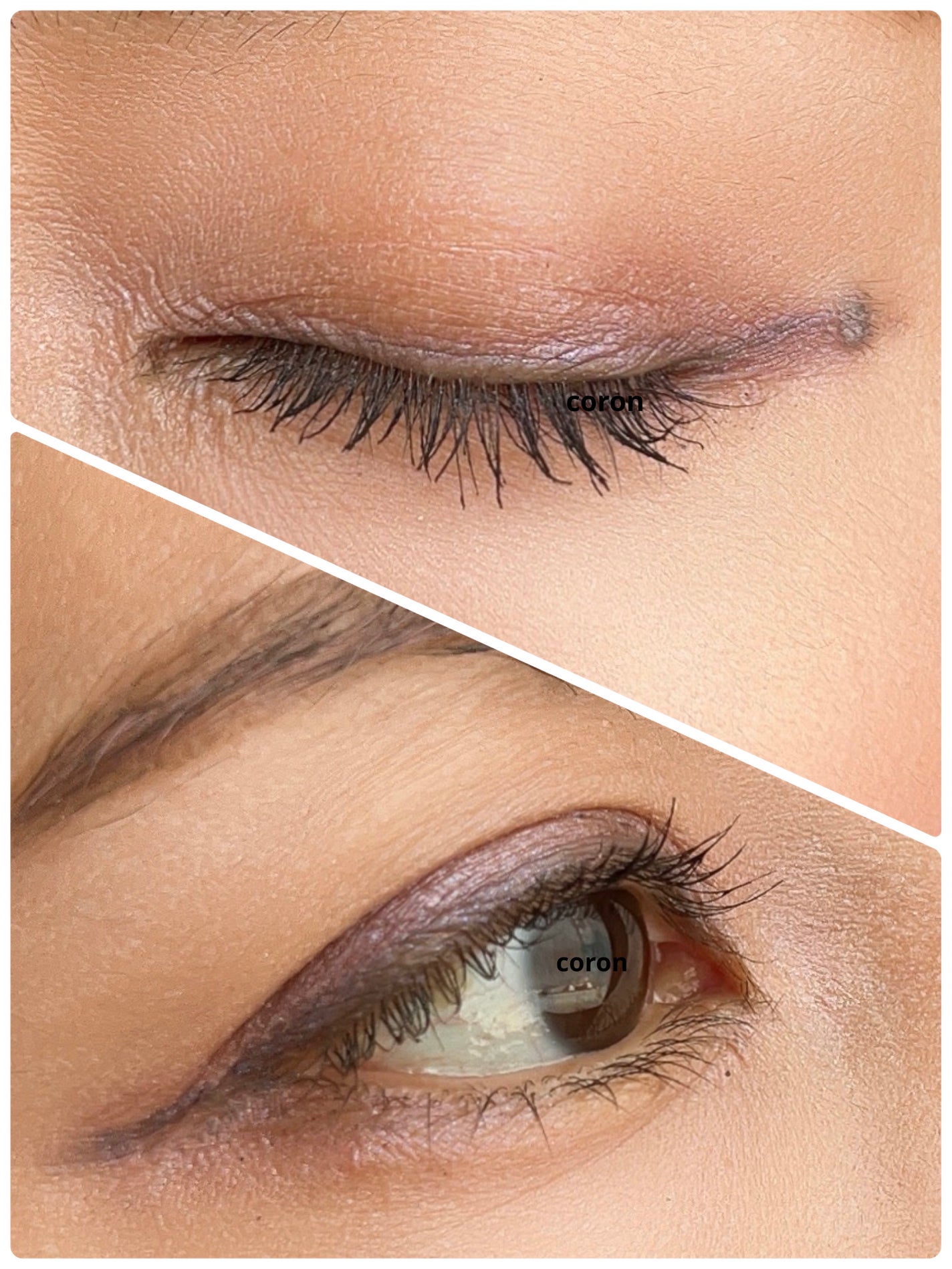 ãã³ã°ïŒã«ãŒã«ãã¹ã«ã© ã¢ããã³ã¹ããã£ã«ã /ããã€ã³ã¡ã€ã¯/ãã¹ã«ã©ã䜿ã£ãã¯ãã³ãïŒ2æç®ïŒ