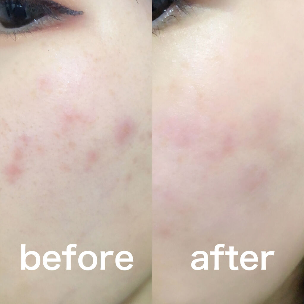 セラムショット　N/PHOEBE BEAUTY UP/美容液を使ったクチコミ（3枚目）