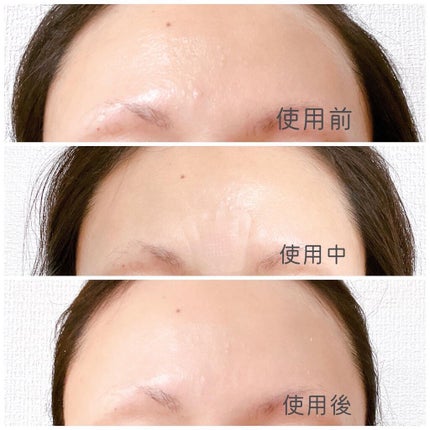 ミケンディープパッチ/北の快適工房/シートマスク・パックを使ったクチコミ(5枚目)