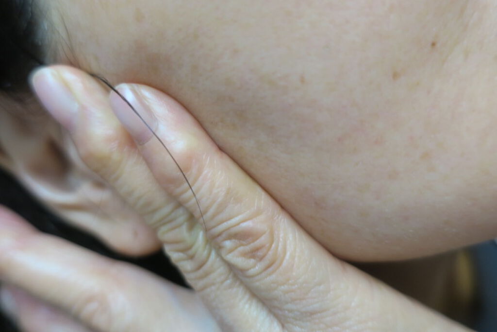 クリーム20/ドモホルンリンクル/フェイスクリームを使ったクチコミ(3枚目)