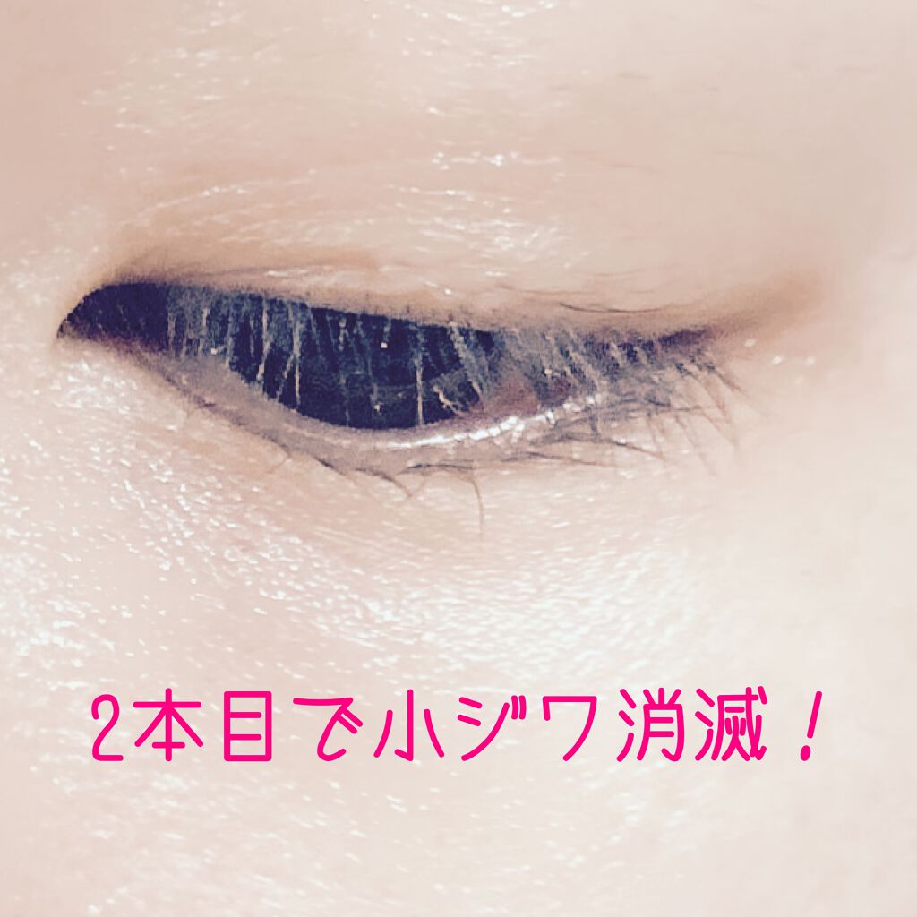 モイスポイント/RICH VISTA/アイケア・アイクリームを使ったクチコミ(1枚目)