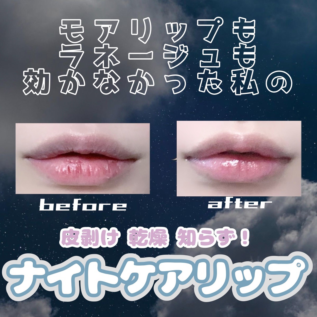 リップケア バーム/キュレル/リップバームを使ったクチコミ（1枚目）