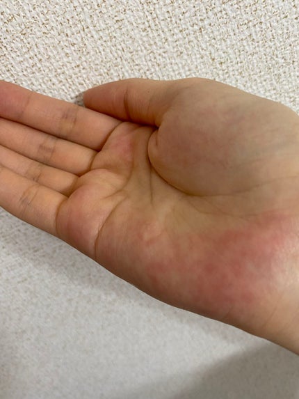 モイストボタニカル 化粧水R/unlabel/化粧水を使ったクチコミ(2枚目)