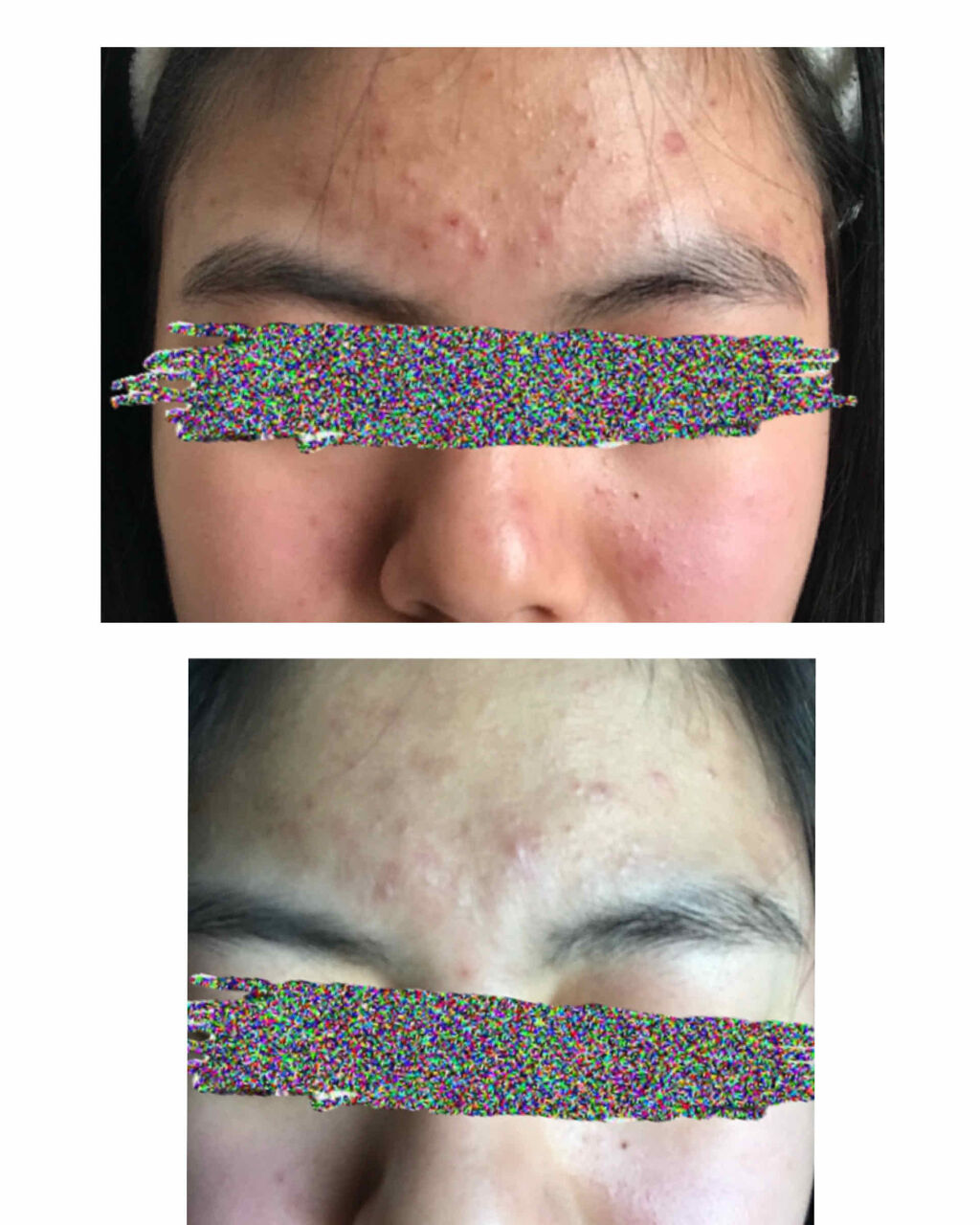 白潤 薬用美白化粧水/肌ラボ/化粧水を使ったクチコミ（2枚目）